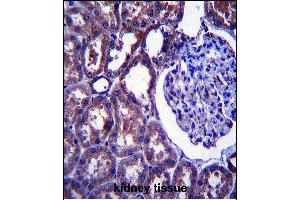 NPC1 Antibody (Center) (ABIN657395 and ABIN2846435) immunohistochemistry analysis in formalin fixed and paraffin embedded human kidney tissue followed by peroxidase conjugation of the secondary antibody and DAB staining.