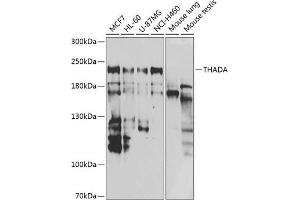 Western blot analysis of extracts of various cell lines, using THADA antibody (ABIN6133115, ABIN6149103, ABIN6149104 and ABIN6222943) at 1:1000 dilution. (THADA anticorps  (AA 1684-1953))