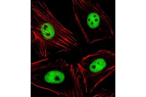 Immunofluorescent analysis of 4 % paraformaldehyde-fixed, 0.