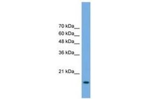 Image no. 1 for anti-Processing of Precursor 5, Ribonuclease P/MRP Subunit (POP5) (AA 71-120) antibody (ABIN6746471)