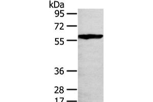 Western Blot analysis of 293T cell using THAP4 Polyclonal Antibody at dilution of 1/250