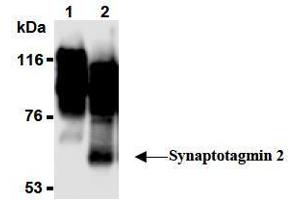 Western Blotting (WB) image for anti-Synaptotagmin II (SYT2) (AA 1-20), (N-Term) antibody (ABIN1449191) (SYT2 anticorps  (N-Term))