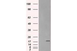 Image no. 2 for anti-Crystallin, alpha B (CRYAB) antibody (ABIN1497648) (CRYAB anticorps)