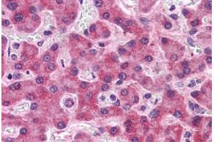 Human Liver: Formalin-Fixed, Paraffin-Embedded (FFPE) (SIPA1L2 anticorps  (N-Term))