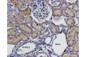 Expression of α2C-Adrenoreceptor in rat kidney - Immunohistochemical staining of rat kidney paraffin embedded sections using Anti-α2C-Adrenergic Receptor (extracellular) Antibody (ABIN7042901, ABIN7043922 and ABIN7043923), (1:100).