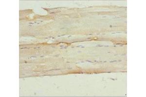 Immunohistochemistry of paraffin-embedded human skeletal muscle tissue using ABIN7161157 at dilution of 1:100 (NPHP3 anticorps  (AA 1-130))