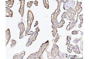 IHC analysis of Collagen VI/COL6A2 using anti-Collagen VI/COL6A2 antibody (ABIN7601439).
