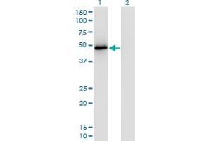 Western Blot analysis of TRAF2 expression in transfected 293T cell line by TRAF2 monoclonal antibody (M04A), clone 4C11. (TRAF2 anticorps  (AA 1-501))