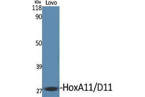 Western Blotting (WB) image for anti-Homeobox A11/D11 (HOXA11 + HOXD11) (C-Term) antibody (ABIN3175529) (HOXA11/D11 anticorps  (C-Term))