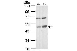 WB Image Sample (30 ug of whole cell lysate) A: Molt-4 , B: Raji 10% SDS PAGE antibody diluted at 1:1000 (TSPYL1 anticorps)