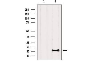 Western blot analysis of extracts from Rat lung, using PLA2G1B Antibody. (PLA2G1B anticorps  (C-Term))