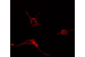 ABIN6274580 staining COLO205 cells by IF/ICC. (ADCY6 anticorps  (Internal Region))