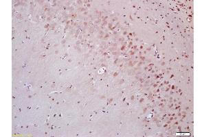 Formalin-fixed and paraffin embedded rat brain labeled with Anti-OCT1 Polyclonal Antibody, Unconjugated (ABIN737286) at 1:200 followed by conjugation to the secondary antibody and DAB staining