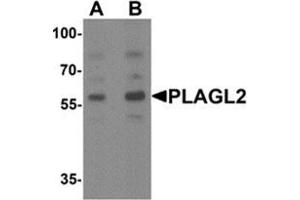 Western blot analysis of PLAGL2 in rat brain tissue lysate with PLAGL2 Antibody  at (A) 1 and (B) 2 ug/ml. (PLAGL2 anticorps  (N-Term))