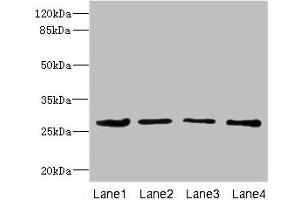 Western blot All lanes: DCXR antibody at 2.