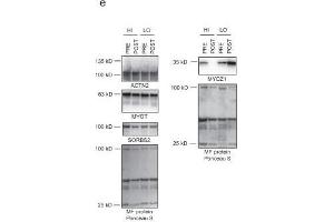 No significant main effects or cluster x time interactions existed for myofibrillar protein levels of ACTN2 (A), MYOT (B), or SORBS2 (D).