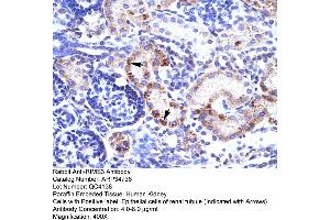 Human kidney (RIMS3 anticorps  (C-Term))