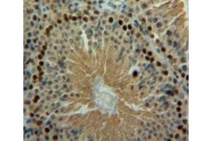 Used in DAB staining on fromalin fixed paraffin-embedded testis tissue (BLMH anticorps  (AA 30-165))