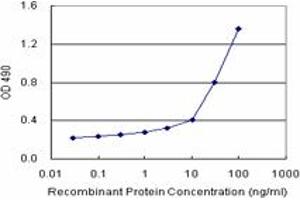 S100A8 (Human) Matched Antibody Pair