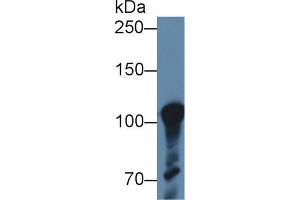 Detection of ABCF1 in Human K562 cell lysate using Polyclonal Antibody to ATP Binding Cassette Transporter F1 (ABCF1) (ABCF1 anticorps  (AA 625-845))