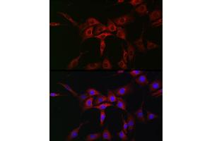 Immunofluorescence analysis of NIH/3T3 cells using  Rabbit pAb (ABIN7265789) at dilution of 1:50 (40x lens).
