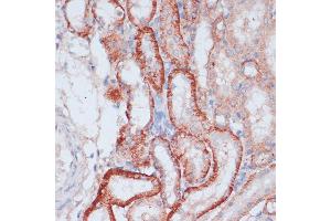 Immunohistochemistry of paraffin-embedded rat kidney using RPL31 antibody (ABIN7270002) at dilution of 1:100 (40x lens).