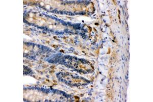 Anti- KCNMA1antibody,IHC(P) IHC(P): Rat Intestine Tissue