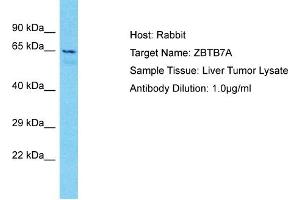 Host: Rabbit Target Name: ZBTB7A Sample Type: Liver Tumor lysates Antibody Dilution: 1. (ZBTB7A anticorps  (N-Term))