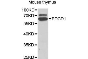 Western blot analysis of extracts of mouse thymus, using PDCD1 antibody (ABIN5973254) at 1/1000 dilution. (PD-1 anticorps)