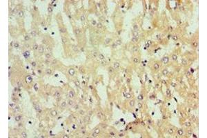 Immunohistochemistry of paraffin-embedded human liver tissue using ABIN7154755 at dilution of 1:100 (Nucleostemin anticorps  (AA 1-240))
