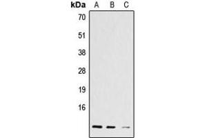 Western blot analysis of Histone H4 (AcK12) expression in A431 (A), L929 (B), C6 (C) whole cell lysates. (Histone H4 anticorps  (acLys12, N-Term))