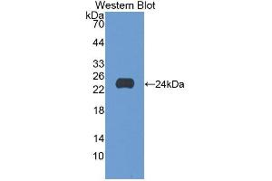 Western blot analysis of the recombinant protein. (GAA anticorps  (AA 70-245))