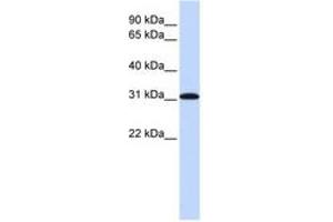 Image no. 1 for anti-Replication Protein A4, 30kDa (RPA4) (AA 180-229) antibody (ABIN6743785) (RPA4 anticorps  (AA 180-229))