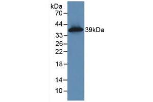 WB of Protein Standard: different control antibodies against Highly purified E. (KRT16 Kit ELISA)