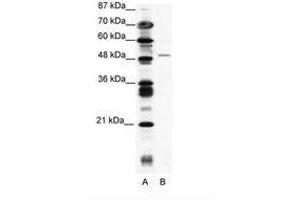 Image no. 1 for anti-Zinc Finger Protein 627 (ZNF627) (AA 44-93) antibody (ABIN202572) (ZNF627 anticorps  (AA 44-93))