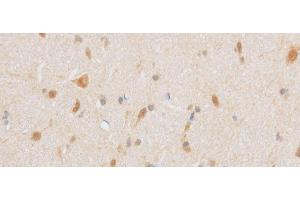 Immunohistochemistry of paraffin-embedded Mouse brain using TRIP4 Polyclonal Antibody at dilution of 1:50 (TRIP4 anticorps)