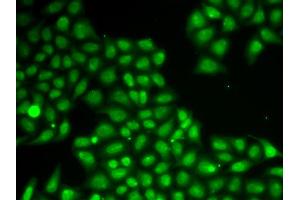 Immunofluorescence analysis of A549 cells using FEN1 antibody (ABIN5970521). (FEN1 anticorps)