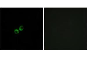 Immunofluorescence analysis of MCF7 cells, using TAS1R3 Antibody. (TAS1R3 anticorps  (AA 326-375))