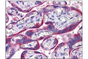Human Placenta: Formalin-Fixed, Paraffin-Embedded (FFPE) (PAPPA2 anticorps  (N-Term))