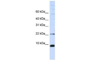 SNRPF antibody used at 1 ug/ml to detect target protein.