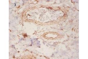 Immunohistochemistry of paraffin-embedded human mammary gland tissue using ABIN7167903 at dilution of 1:50 (ARHGDIA anticorps  (AA 2-204))