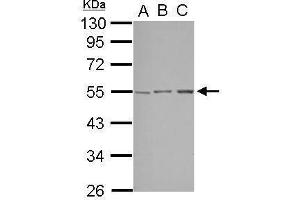 WB Image Sample (30 ug of whole cell lysate) A: A549 B: HepG2 C: HCT116 10% SDS PAGE antibody diluted at 1:1000 (STK38L anticorps)