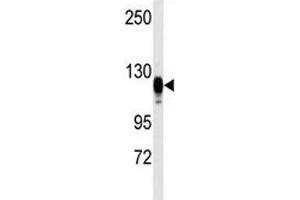Western blot analysis of EGF Receptor antibody and kidney heart tissue lysate
