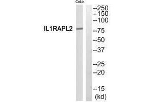 Western blot analysis of extracts from COLO205 cells, using IL1RAPL2 antibody. (IL1RAPL2 anticorps)