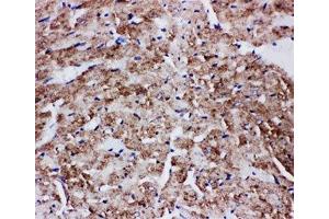IHC-P: GLUT4 antibody testing of rat heart tissue (GLUT4 anticorps  (AA 491-509))