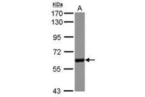 Image no. 2 for anti-Carboxylesterase 2 (CES2) (AA 310-522) antibody (ABIN1497478)