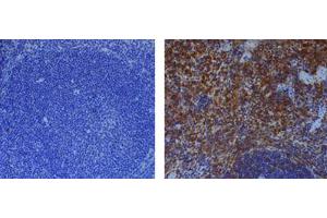 Immunohistochemical staining of endogenous mouse Caspase-1 in mouse spleen using anti-Caspase-1 (p20) (mouse), mAb (Casper-1)  (1:500) by standard immunohistochemistry (antigen retrieval performed with sodium citrate). (Caspase 1 p20 anticorps)