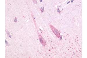 Immunohistochemical staining of Brain (Neuron) using anti- TAAR1 antibody ABIN122429 (TAAR1 anticorps  (Cytoplasmic Domain))