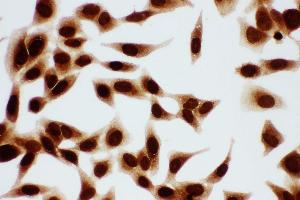 Anti-MCM7 antibody, ICC ICC: HELA Cell