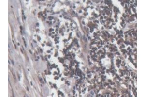 DAB staining on IHC-P; Samples: Human Lymph node Tissue (Perforin 1 anticorps  (AA 32-316))
